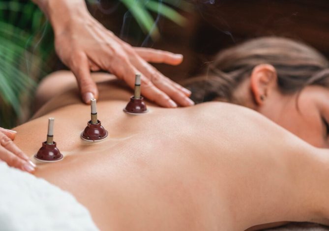 Cupping therapy near me
